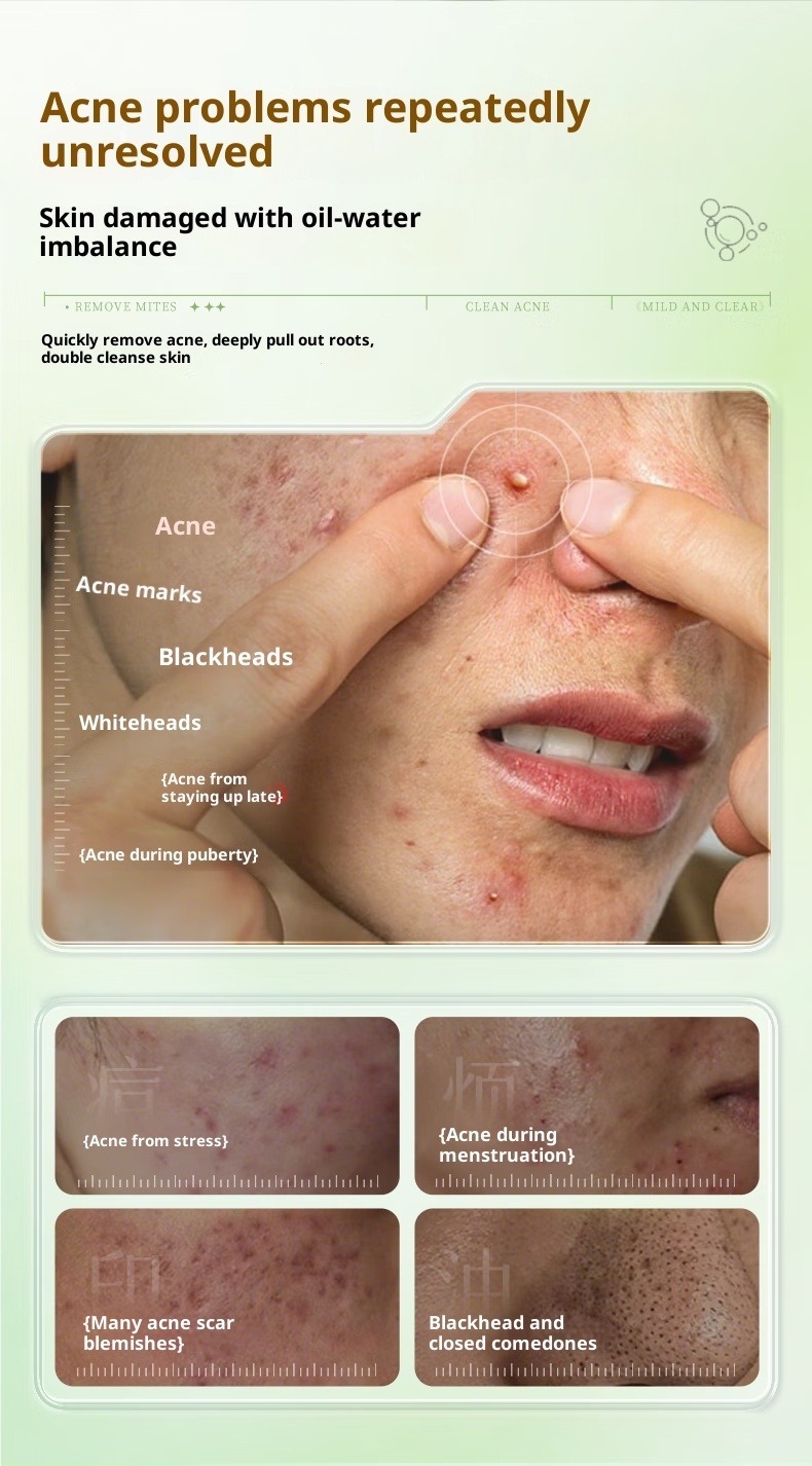 acne scars skin care products